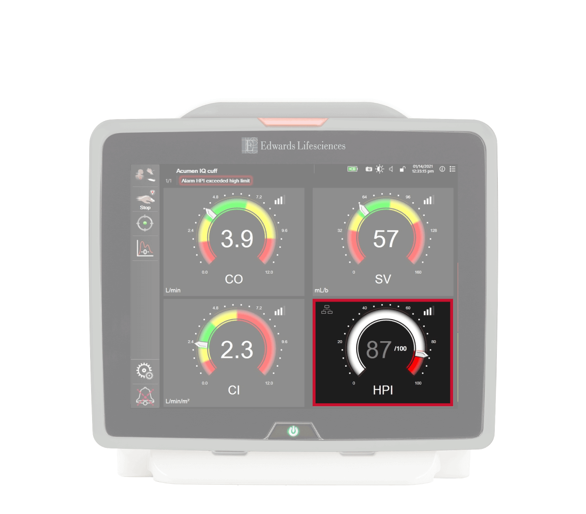 HPI Parameter