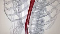 Transcatheter SAPIEN 3 TAVR gallery item 1
