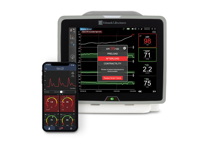 HemoSphere platform