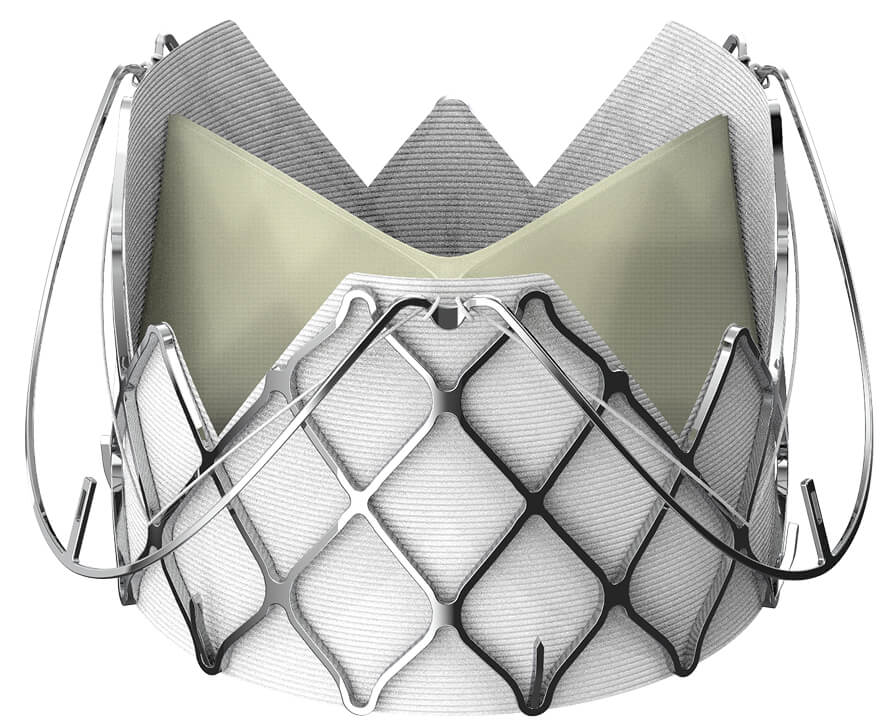 What is TAVR-AR