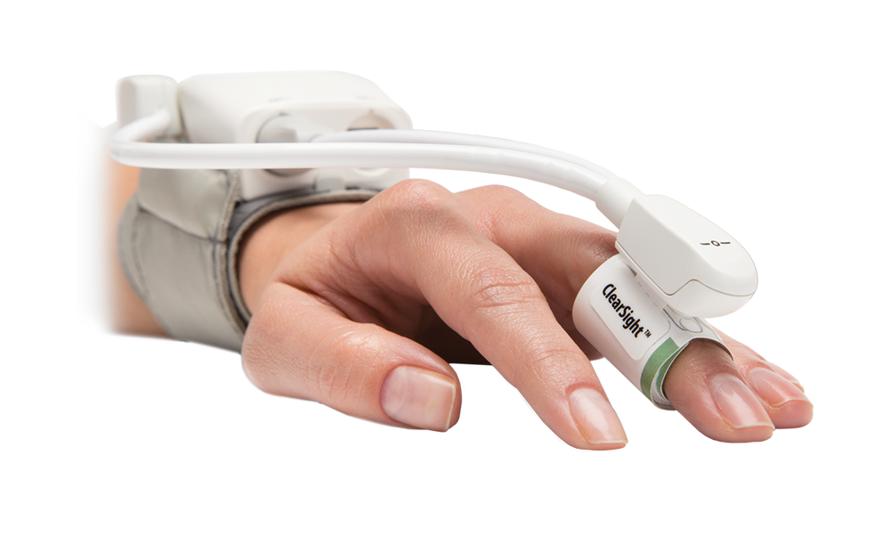 ClearSight cuff