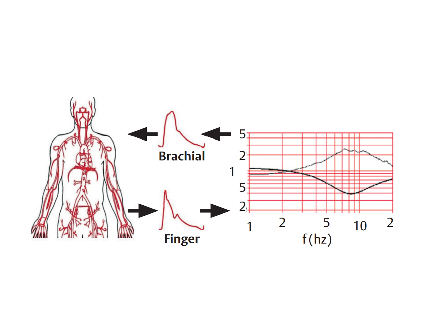 Brachial pressure reconstruction