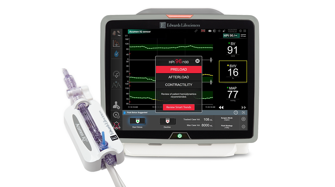 Acumen IQ sensor