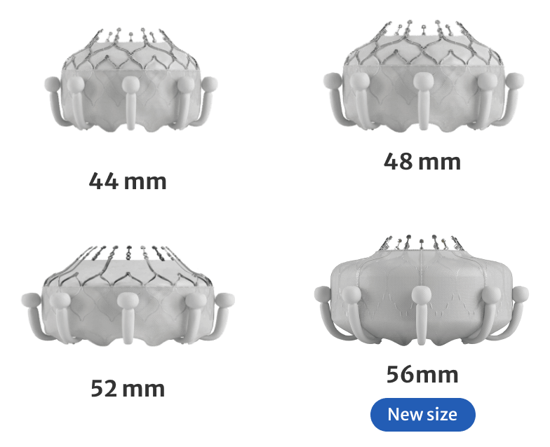 Multiple valve sizes