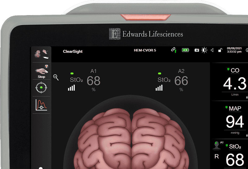 HemoSphere advaced platform image
