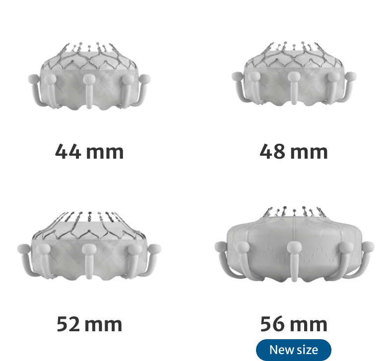 Multiple valve sizes