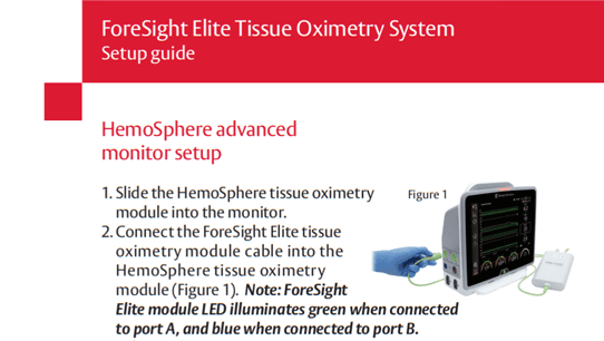 foresight guide thumbnail