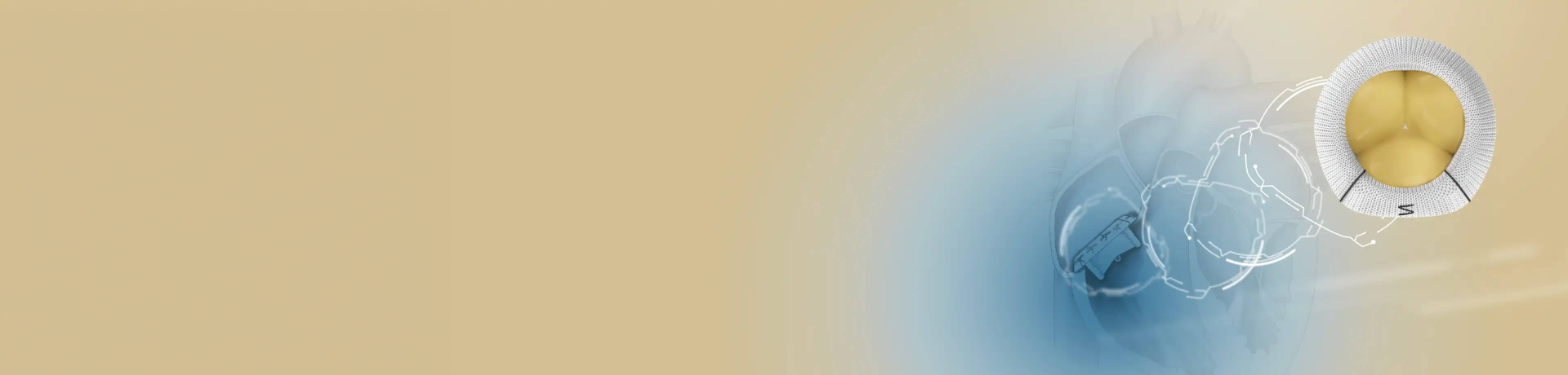 Triformis banner