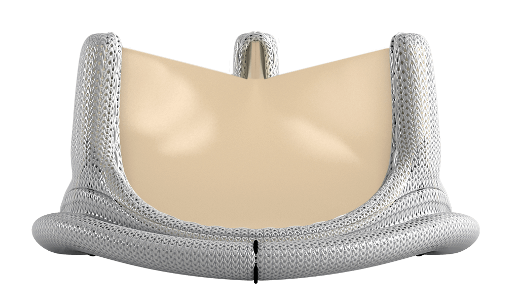 Magna Ease