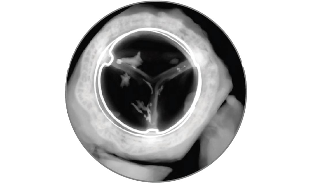 Control valve (6900P)