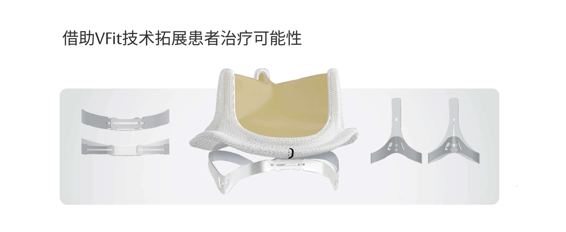 Expanding patient possibilities with VFit technology