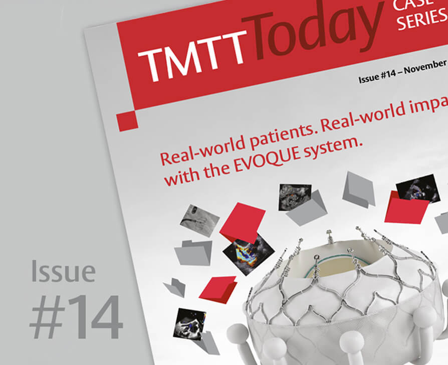 TMTT Today issue #14 – image
