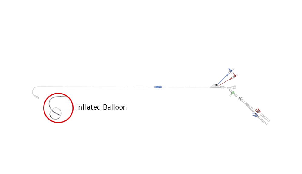 IntraClude device features