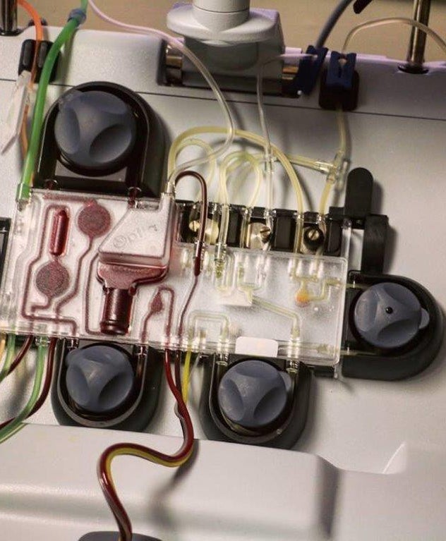 Apheresis Machine | Sharing America’s Marrow