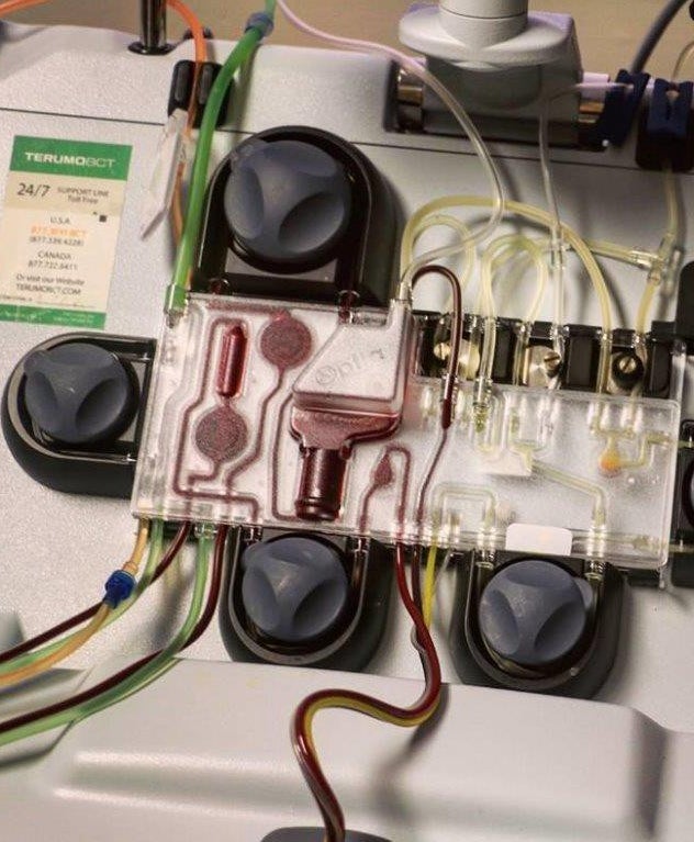 Apheresis Machine | Sharing America’s Marrow