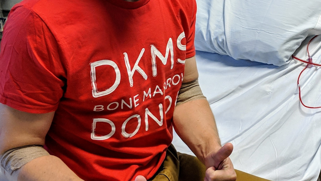 Two thumbs up for saving lives. This is me after the PBSC procedure to remove my blood stem cells.