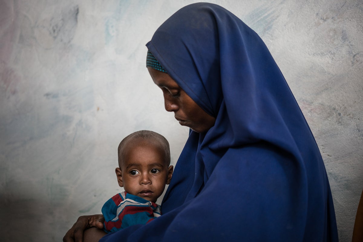 A mother cradles her malnourished son