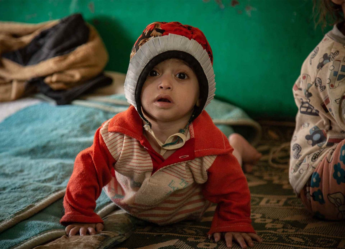 Arwa Al-Oshari, 14 months old, who is suffering from malnutrition, plays in a tent with his family in a camp for the displaced people in Yemen. © UNICEF/UNI337487