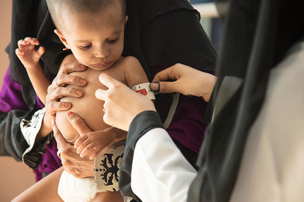 A health worker is assessing a baby for malnutrition.