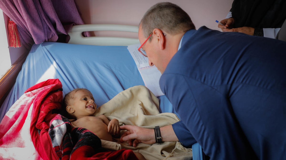 A visibly malnourished baby smiles to a man that is looking at them.