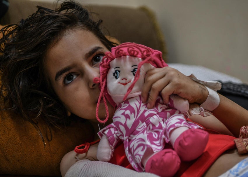 Eight-year-old girl from Gaza City in a hospital with severe injuries. 