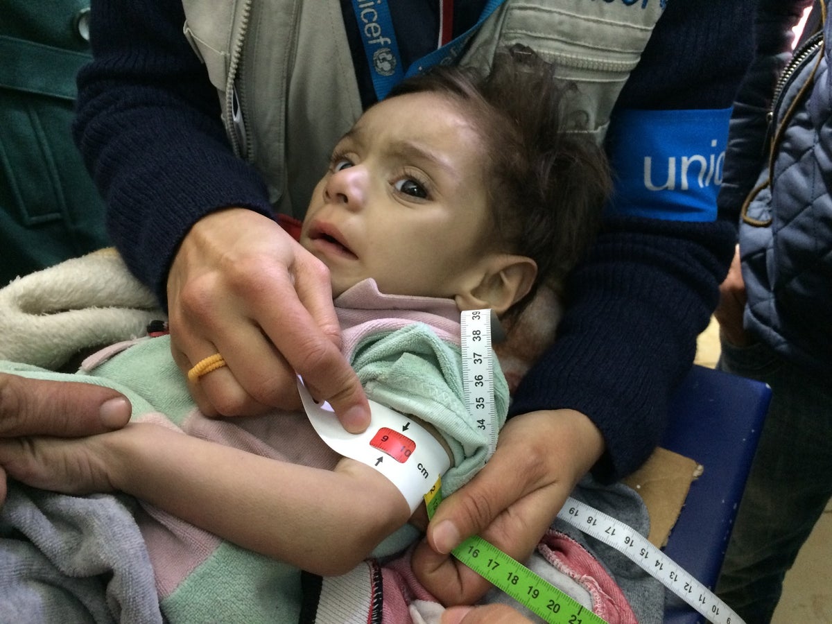 A young child is assessed for malnutrition