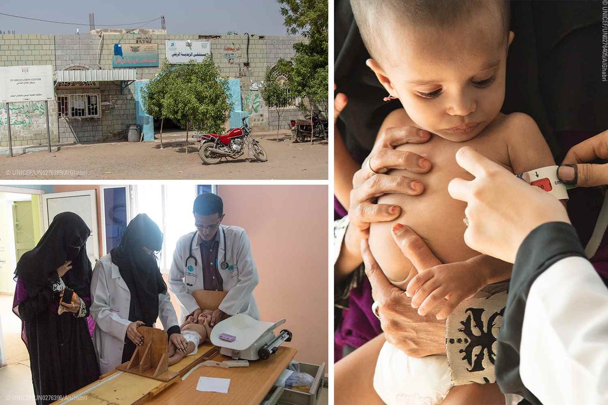 Life in the centre (top left) revolves around saving the lives of Yemen’s children - many of whom, like Doa’a (right), are admitted with Severe Acute Malnutrition.