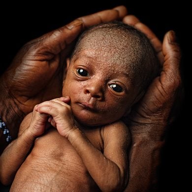Nahawa was born premature in Bougouni, Mali, and weighed just 1.2kg.