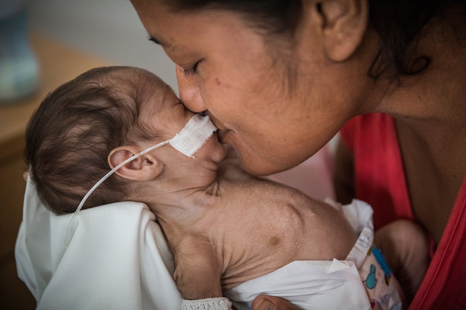 Tasillima holds and kisses her 1-month-old son Mativa. He is malnourished and a premature baby 