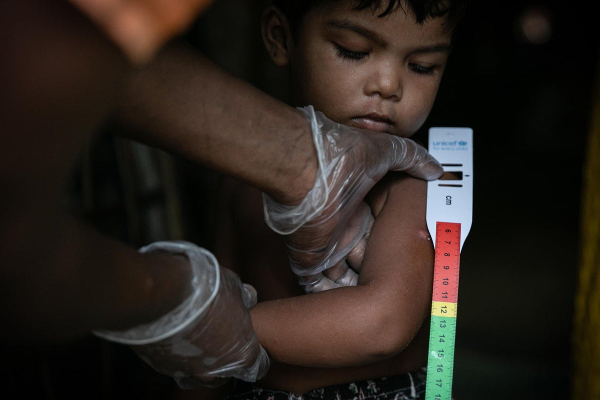 A health worker assesses a toddler for malnutrition.