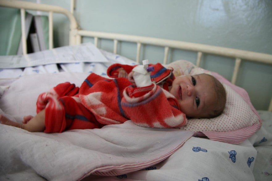 Helal, two-months-old, is malnourished. Undernutrition at an early age can have serious effects on the physical and mental development of children