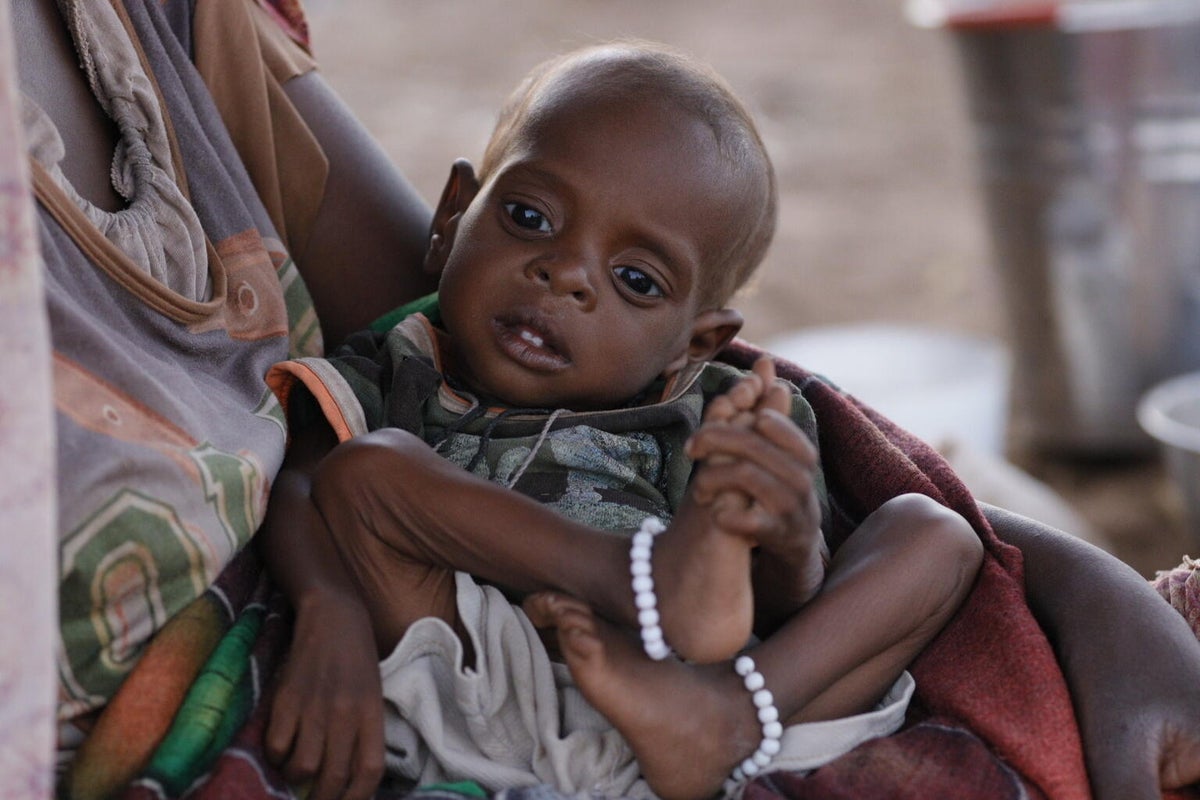A young baby suffering from malnutrition in Sudan.