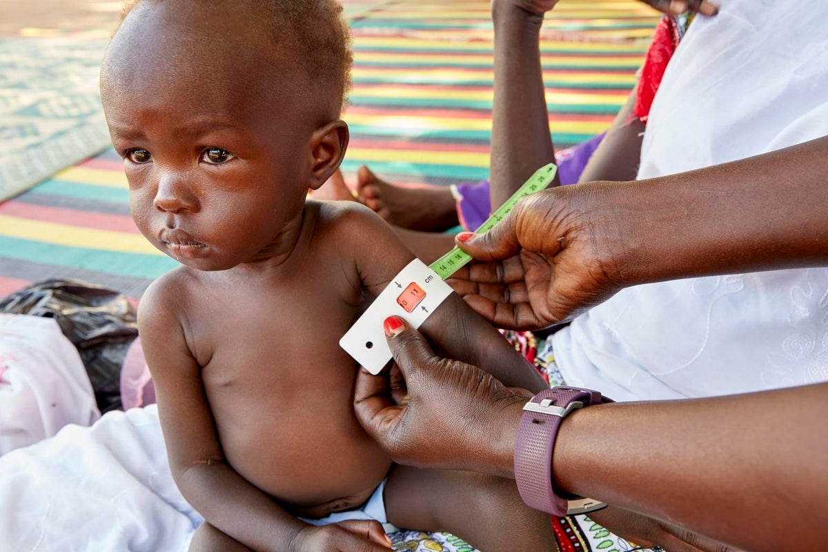 A toddler is assesed for malnutrition by a health worker.