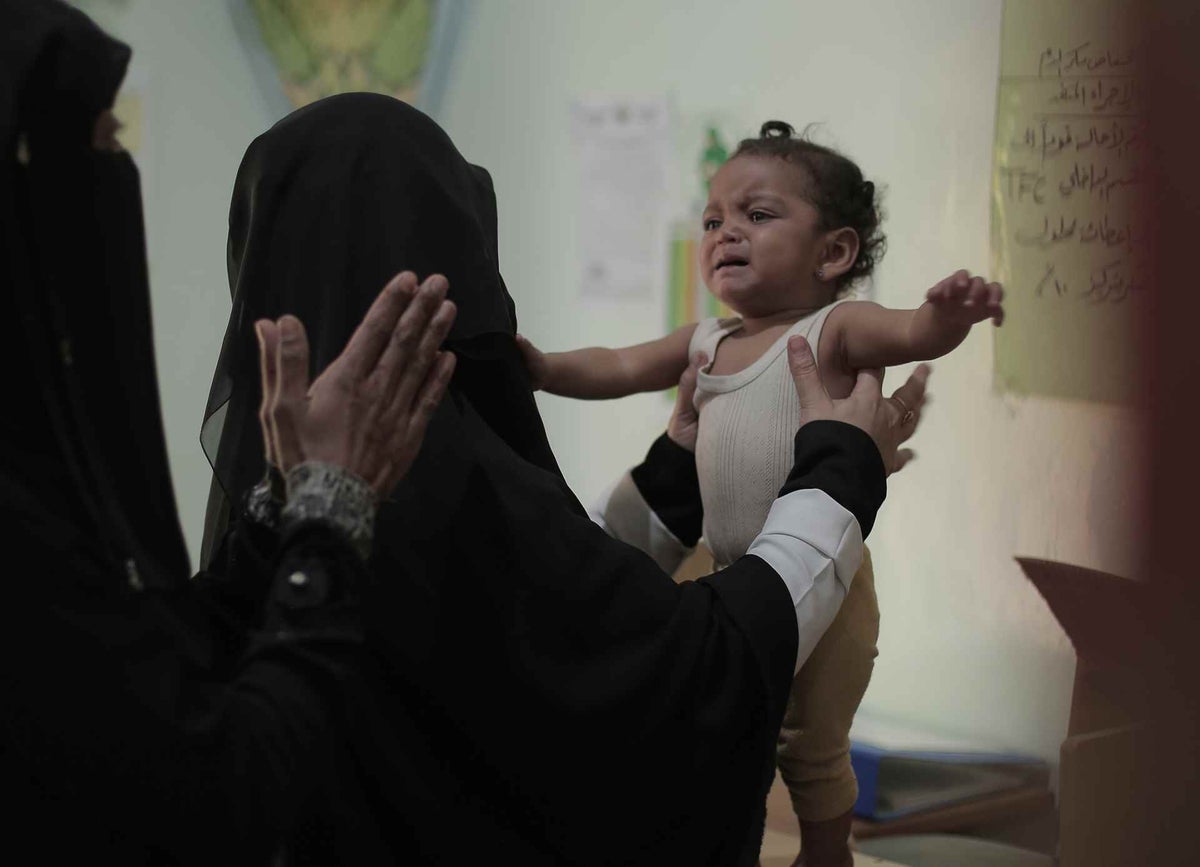 Nour is checked by medical staff at a health centre in Sana'a, Yemen