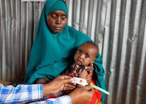 Mother holding her child in Somalia who is suffering from malnutrition
