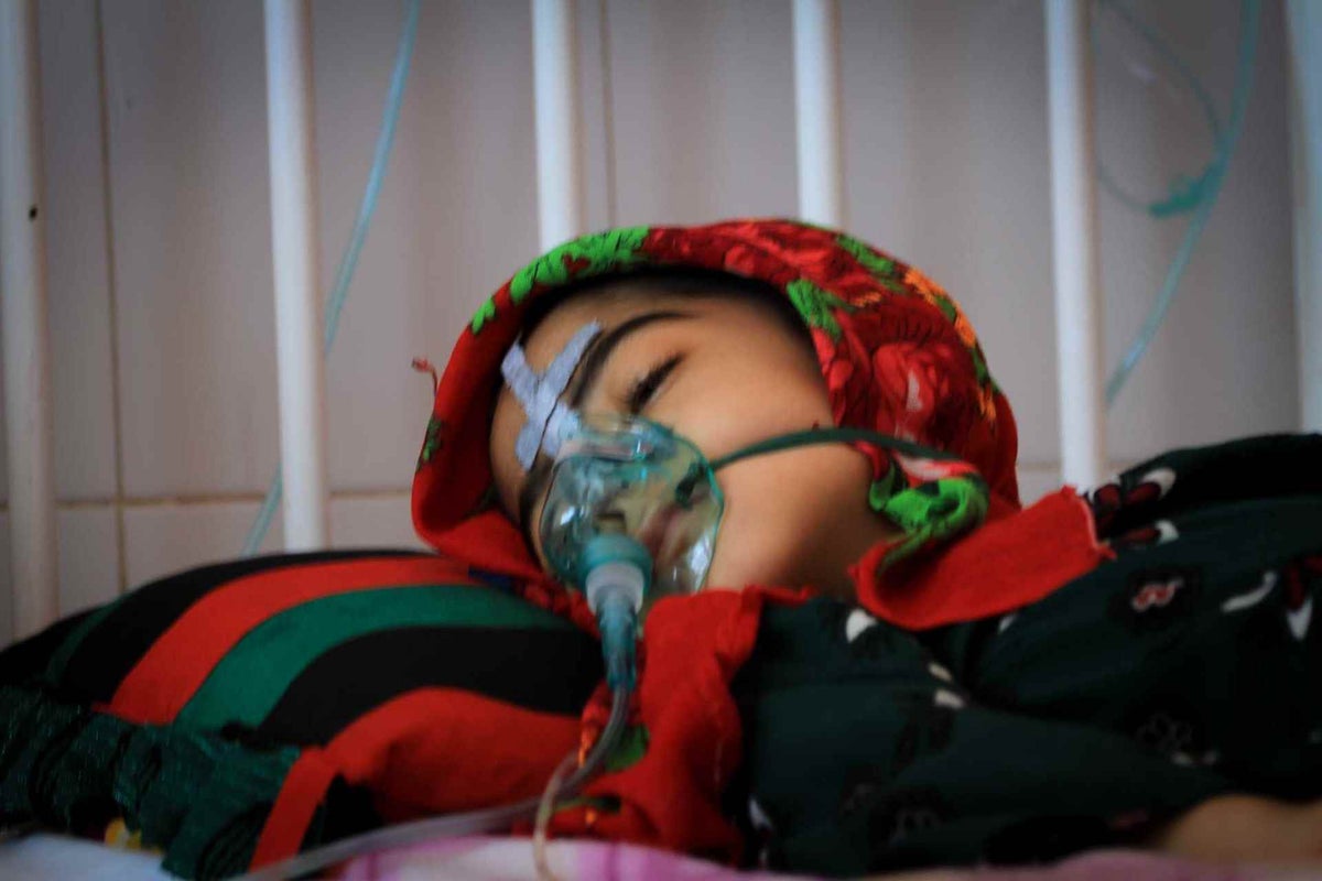 Child with eyes closed, wearing oxygen mask in hospital