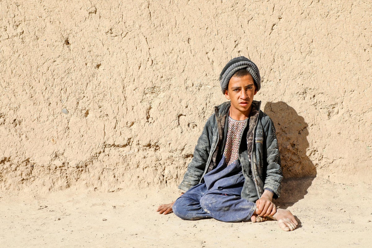 A boy is seating on the floor against a wall. His legs are paralysed.