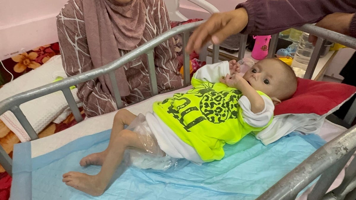 A five-month-old being treated for severe malnutrition in Gaza. 