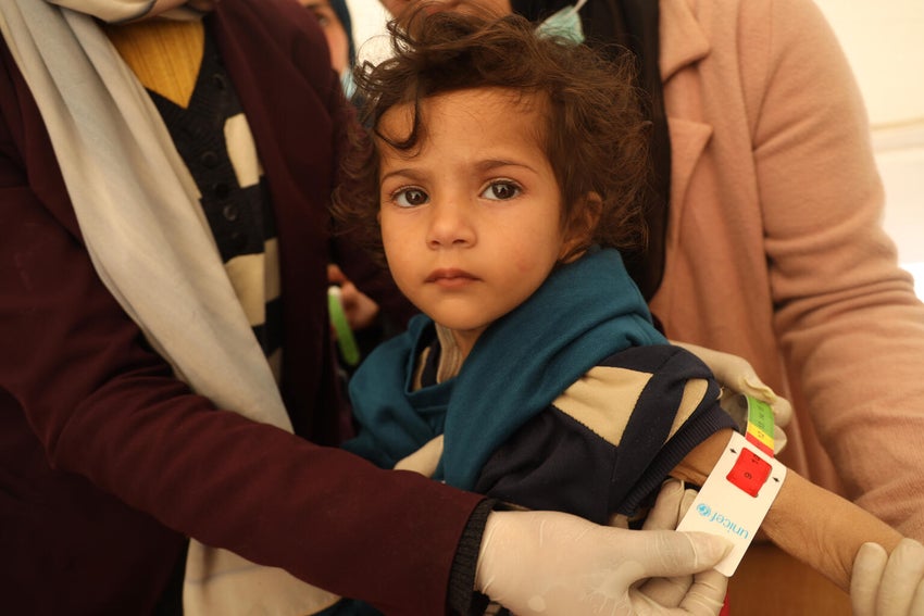 In the Gaza Strip, two-year-old Leen is getting her middle-upper-arm-circumference (MUAC) measured. The red zone indicates that Leen has the most severe form of malnutrition.
