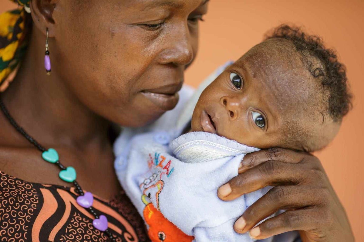 Fanta Konteh, who doesn't know her age, holds her son in Makeni, Sierra Leone, in 2013. Her son Alhussein is severely malnourished. 
