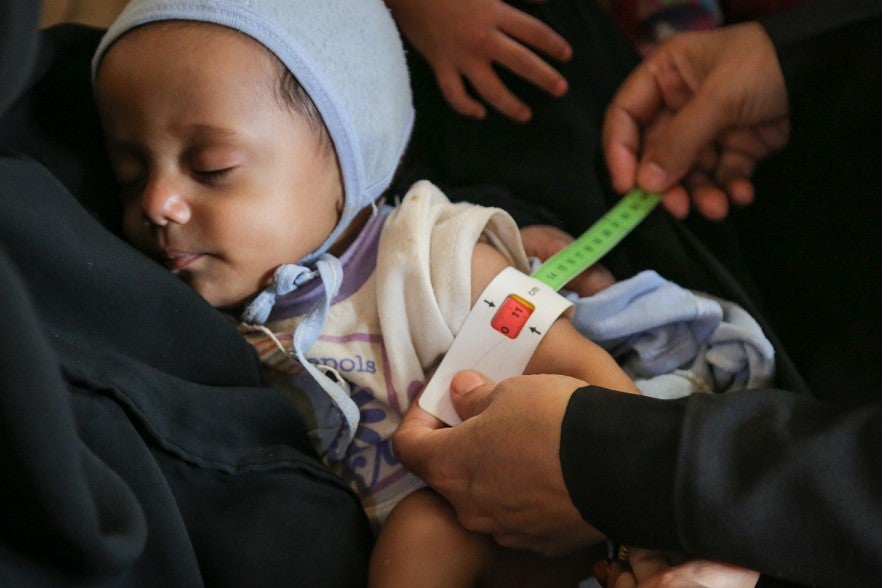 Salim is measured with a MUAC band by a health worker which shows he is severely malnourished