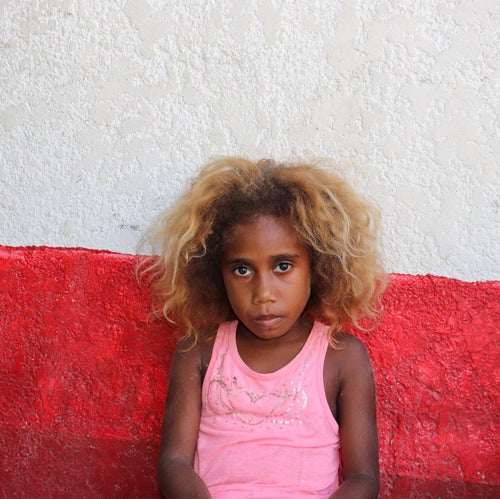 Young girl affected by the cyclones in Vanuatu