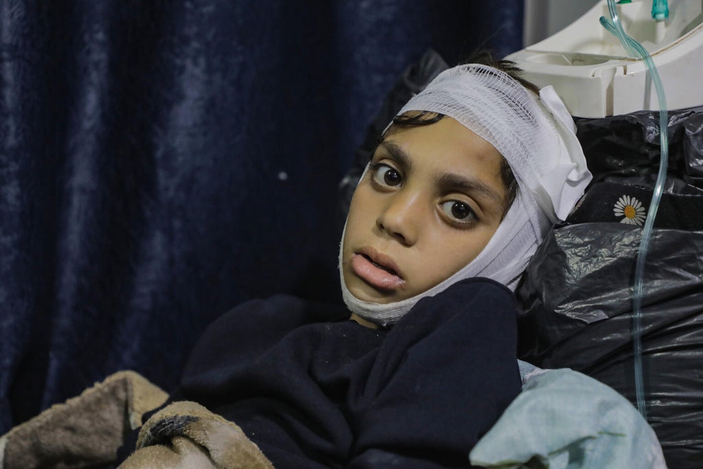 A child being treated for injuries in Gaza.