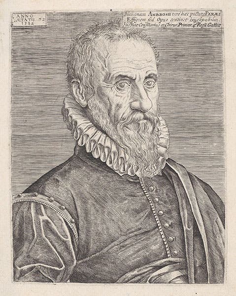 Portrait of Ambroise Paré, age 72, engraving by Stephanus Delaune, 1582, Metropolitan Museum of Art, New York (metmuseum.org)