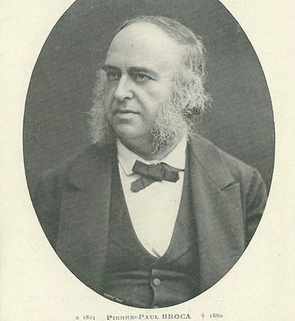 Portrait of Paul Broca, photograph, undated, 1870s? (Wikimedia commons)