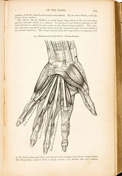 Wood engraving of a dissected human hand, by Henry Vandyke Carter, in Anatomy, Descriptive and Surgical, by Henry Gray and Henry Vandyke Carter, fig. 159, p. 265, first edition of 1858, copy at auction by Sotheby’s, 2020 (sothebys.com)