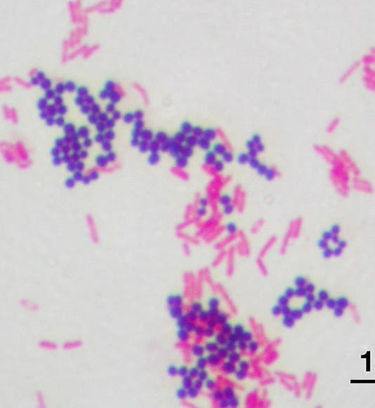 Staphylococcus aureus (dark purple) and Escherichia coli (pink) after Gram staining and counter-staining (Wikimedia commons)