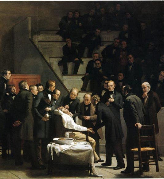 <i>First Operation Under Ether</i>, by Robert C. Hinckley, Boston Medical Library in the Francis A. Countway Library of Medicine, 1882-1893 (Wood Library-Museum of Anesthesiology)