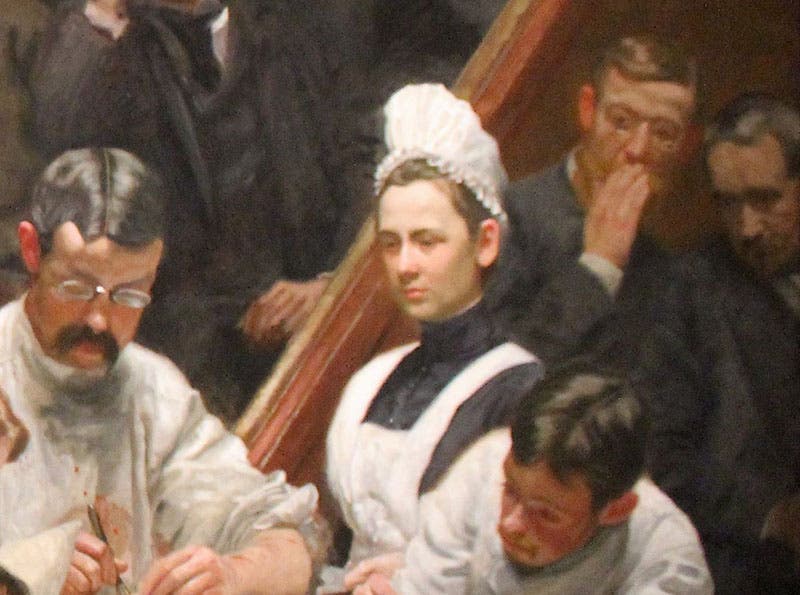 Detail of The Agnew Clinic, by Thomas Eakins (second image), showing Mary Clymer. The man in the audience at far right is a portrait of Eakins, supposedly painted by his wife (Wikimedia commons)