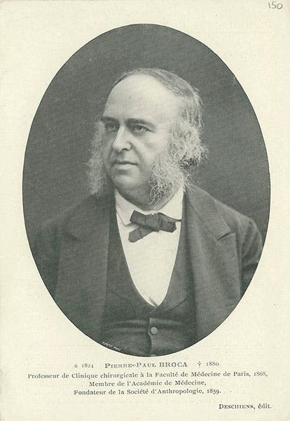 Portrait of Paul Broca, photograph, undated, 1870s? (Wikimedia commons)